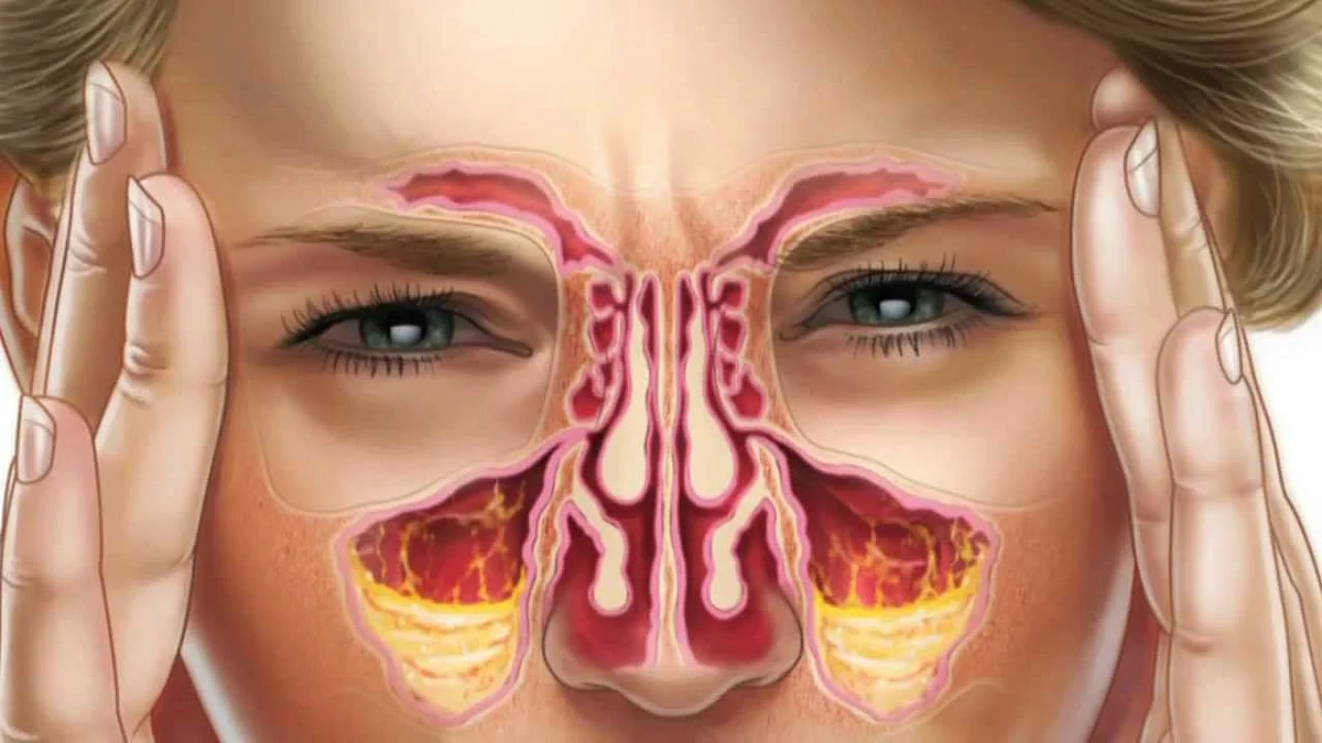 Sinus