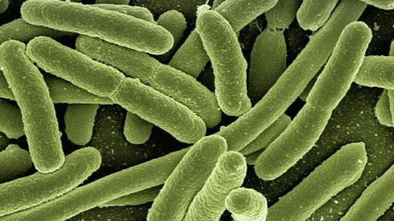 Bubonic Plague