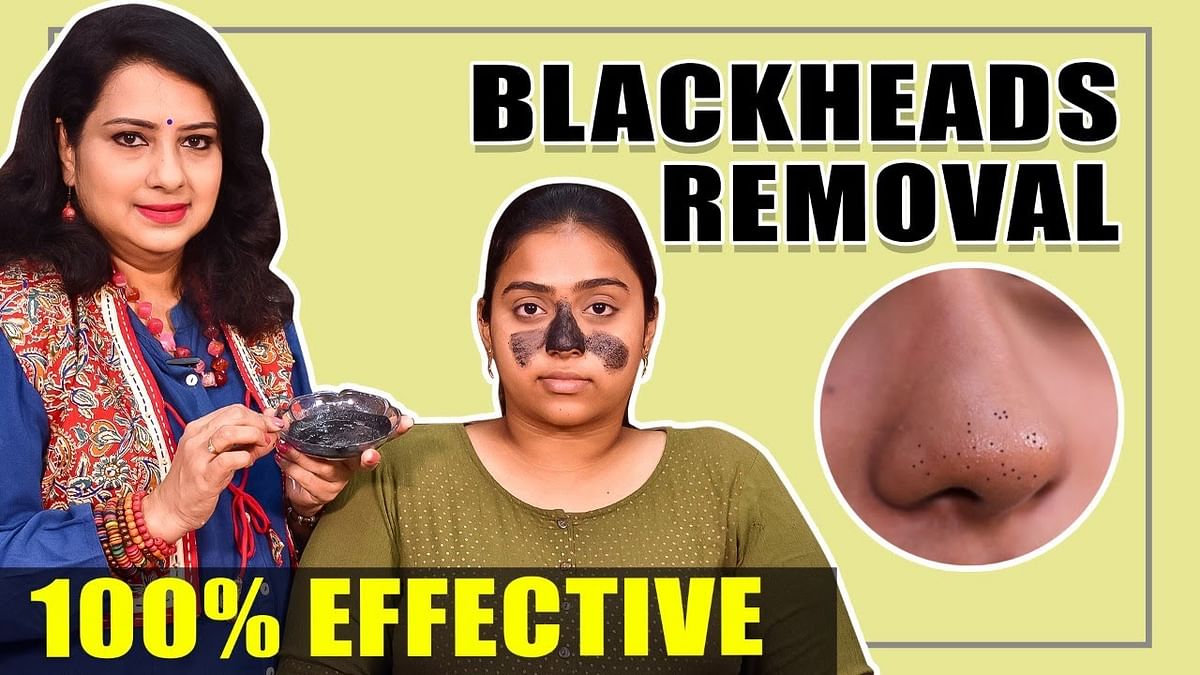blackhead removal