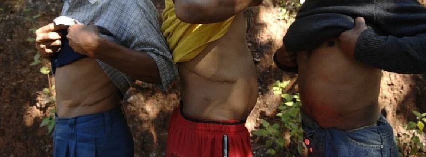 சிகிச்சை முடிந்தவர்கள்