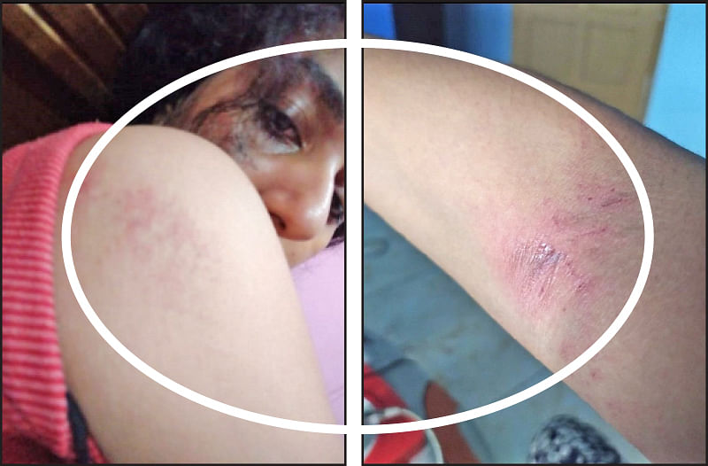 விஸ்மயா... சாம்பலில் கரைக்கப்பட்ட உன் கனவுகளுக்காக வருந்துகிறேன்!