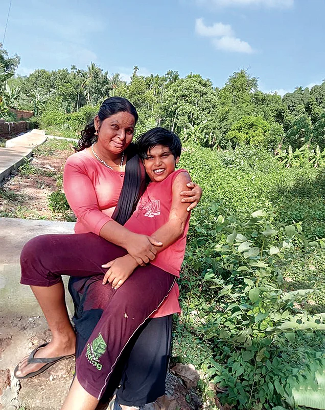 பதம் பார்த்த ஆசிட்...
மீட்டெடுத்த மன உறுதி! -
தன்னம்பிக்கை மனுஷி ரின்ஸியின் கதை