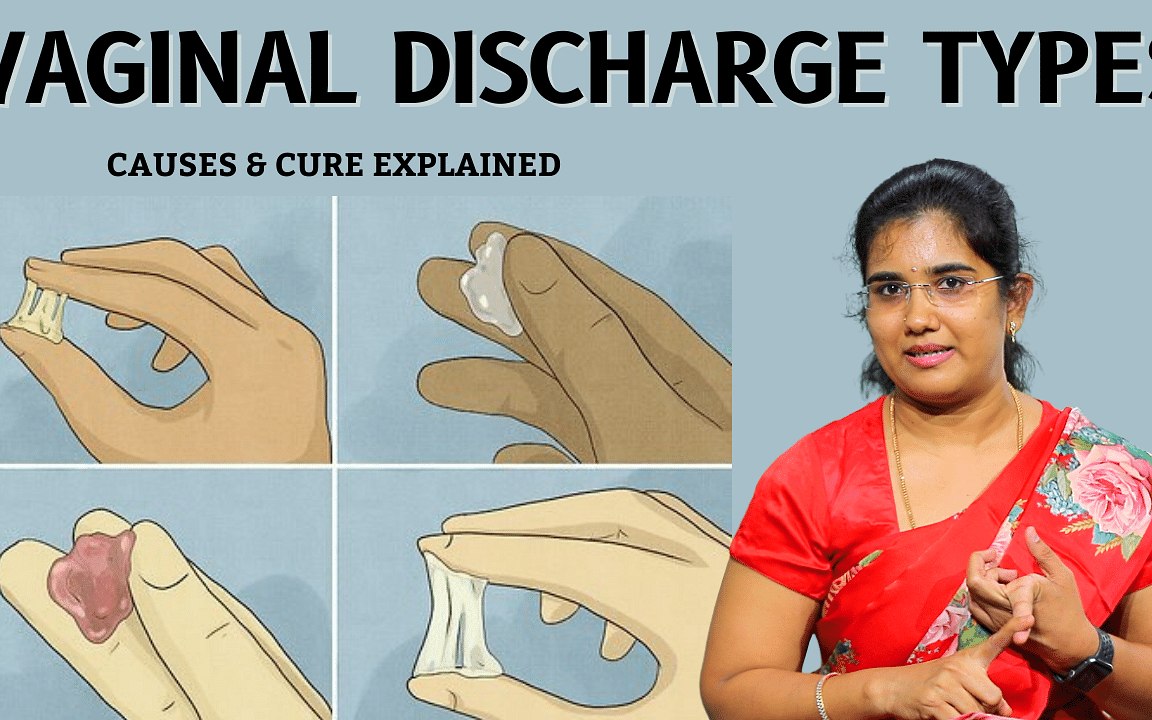 White Discharge: எது Normal? எது Abnormal? | Vaginal Discharge Types & Reasons Explained | Say Swag