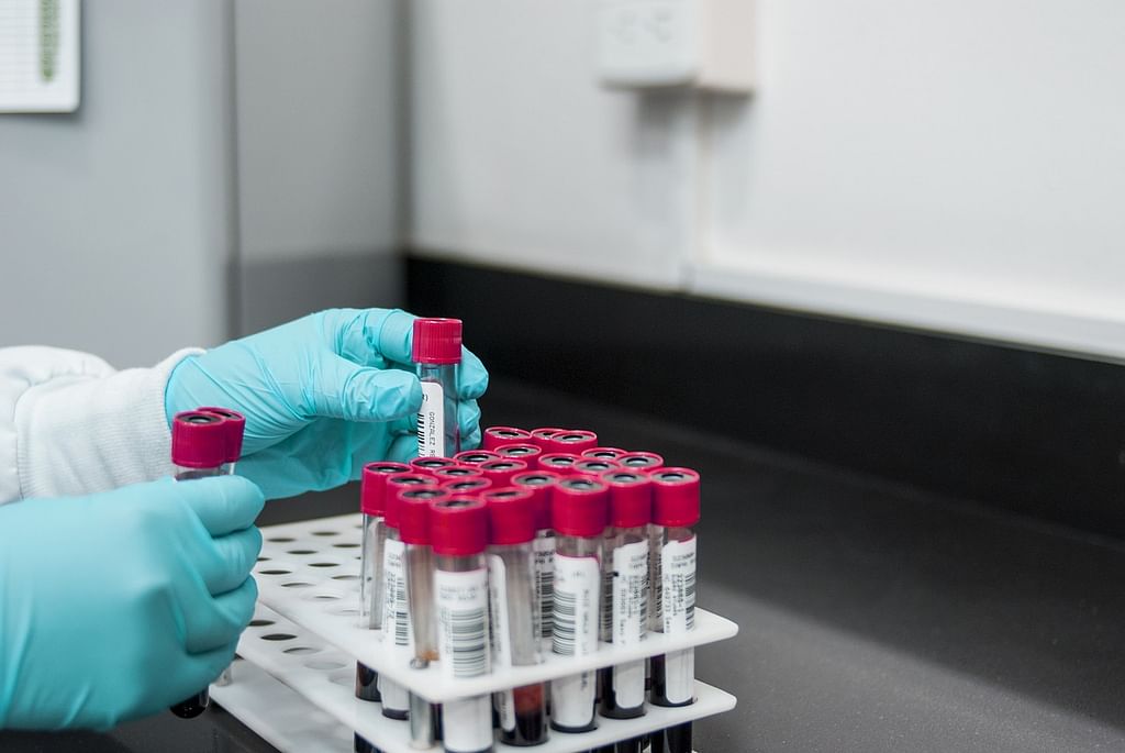 Blood Samples (Representational Image)