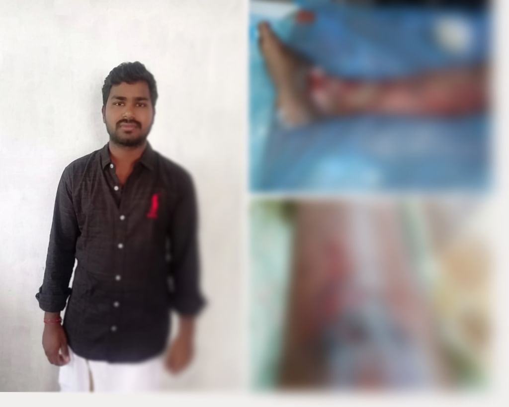 விஜயகுமார் - கால் செப்டிக் ஆன நிலையில்...