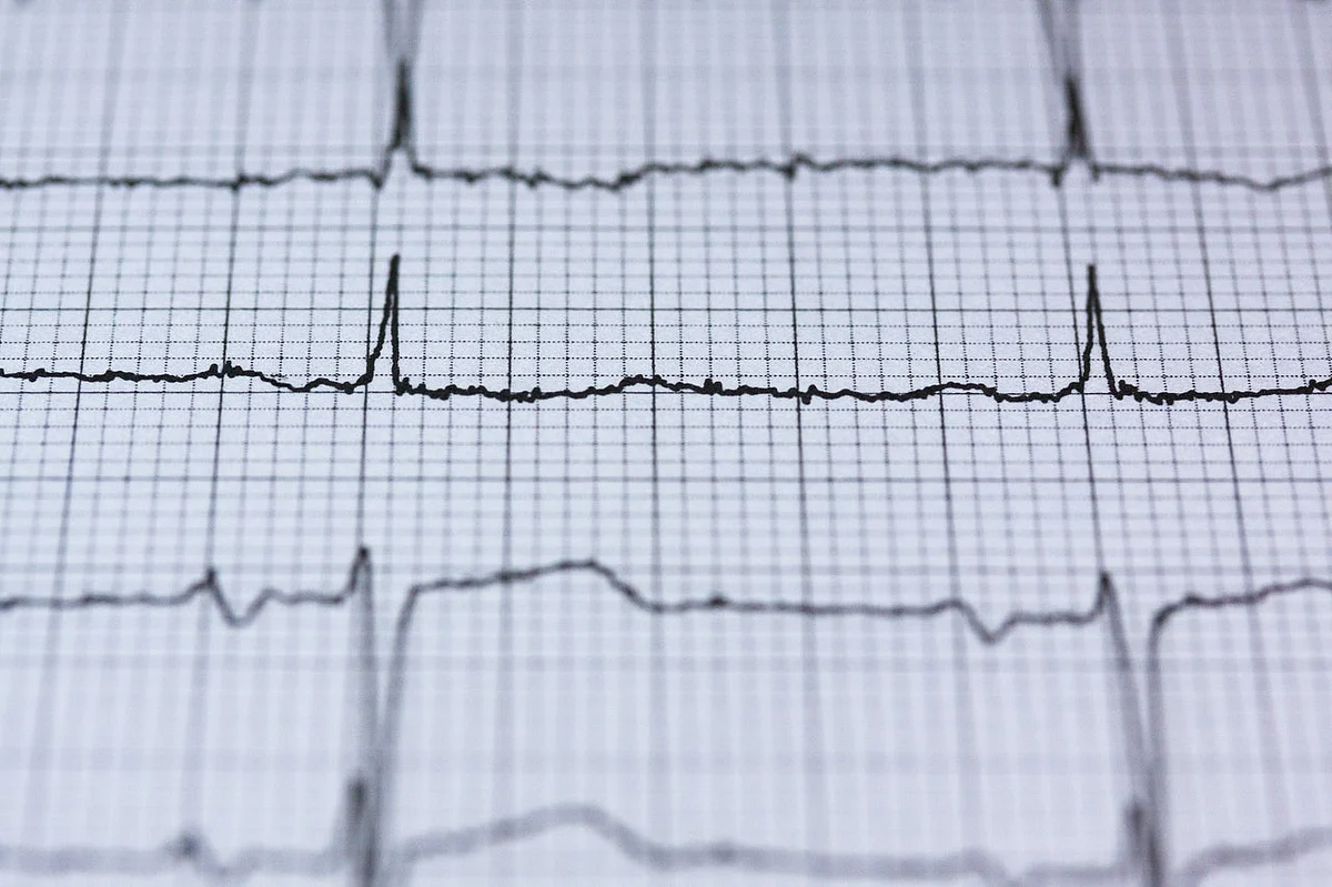 Heart Beat (Representational Image)