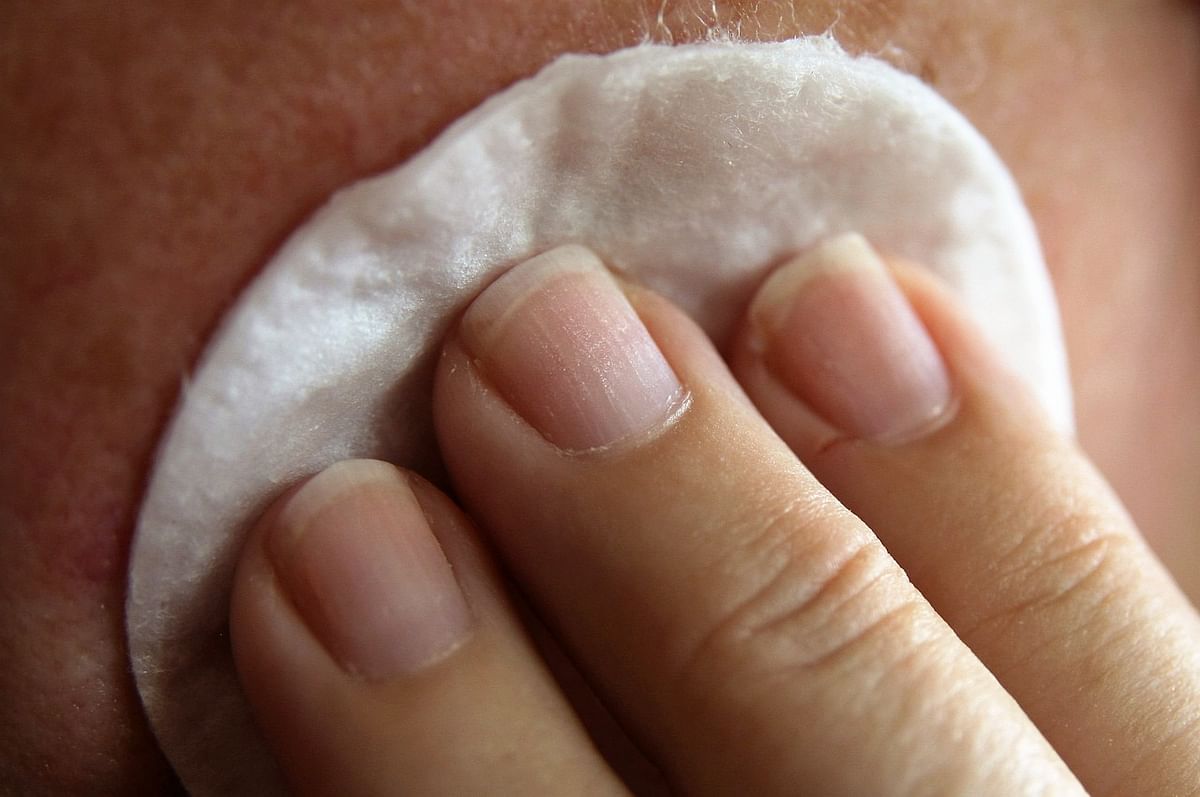 Pimples (Representational Image)