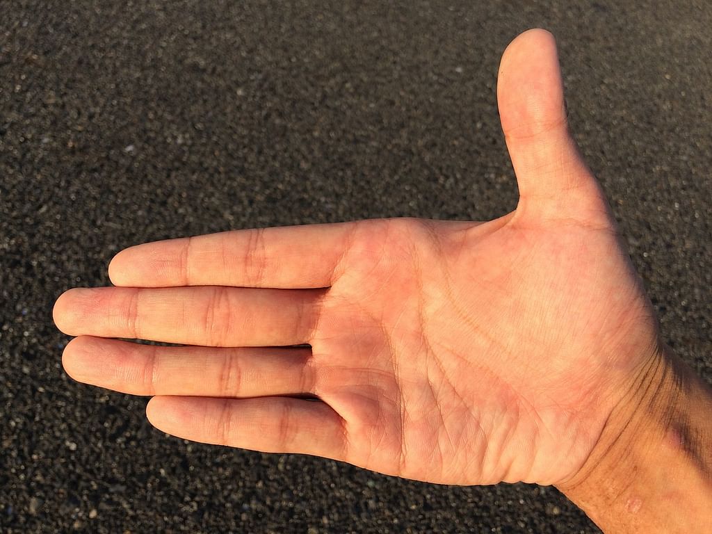 Hands (Representational Image)