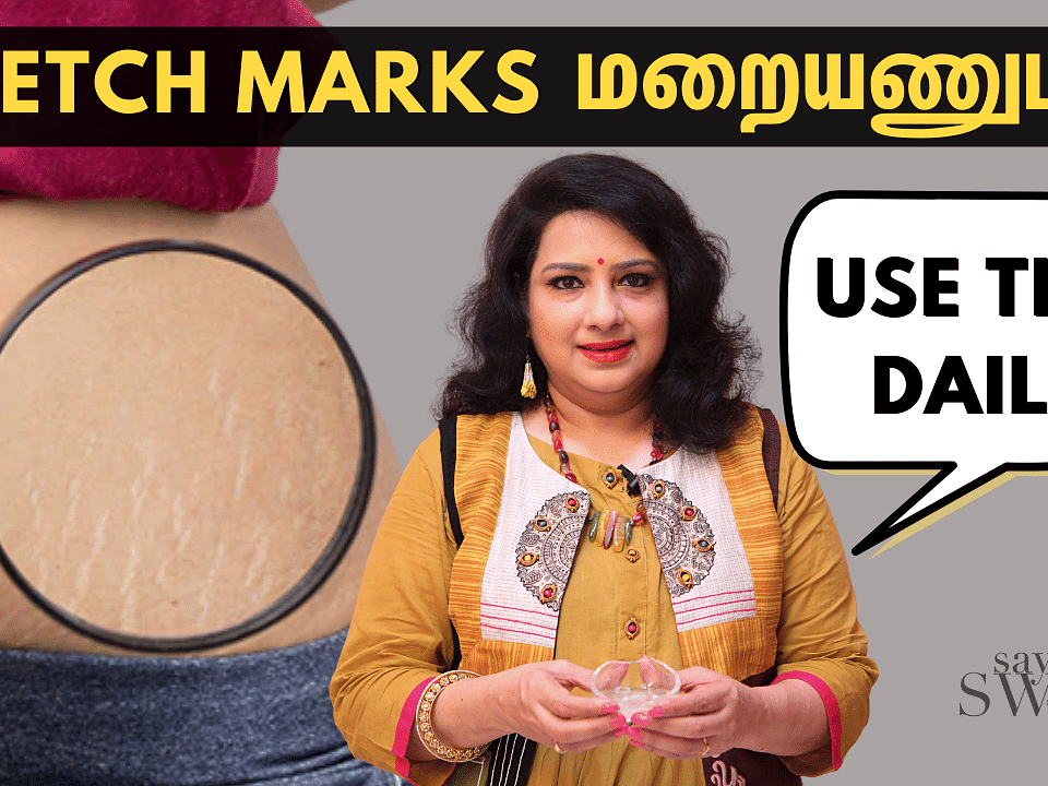 How To Remove Stretch Marks Easily At Home? | DIY Home Remedies | Vasundhara Tips | Say Swag