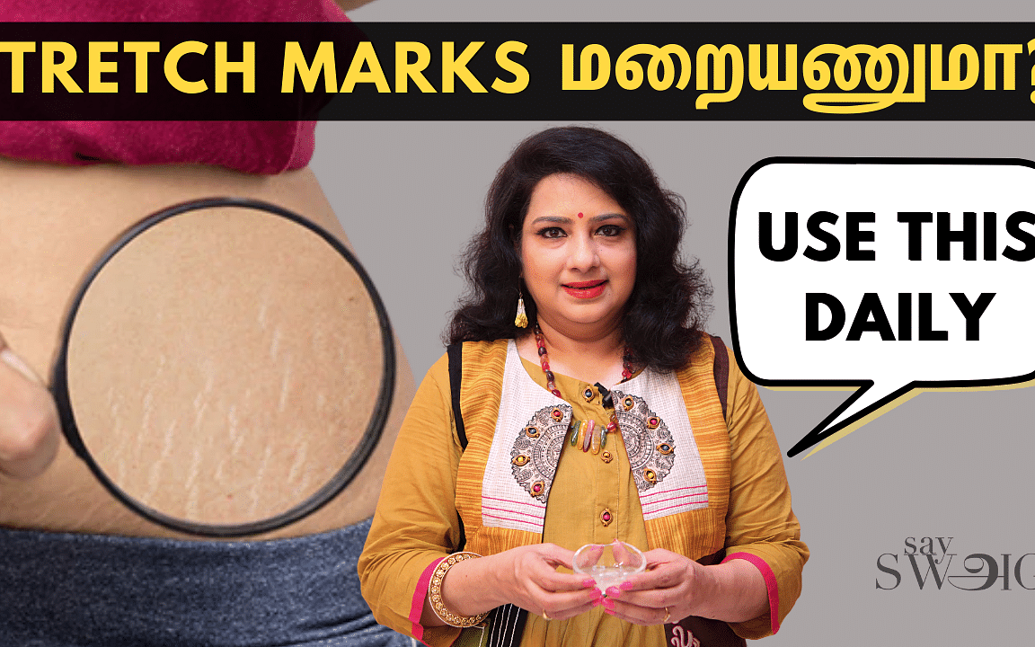 How To Remove Stretch Marks Easily At Home? | DIY Home Remedies | Vasundhara Tips | Say Swag