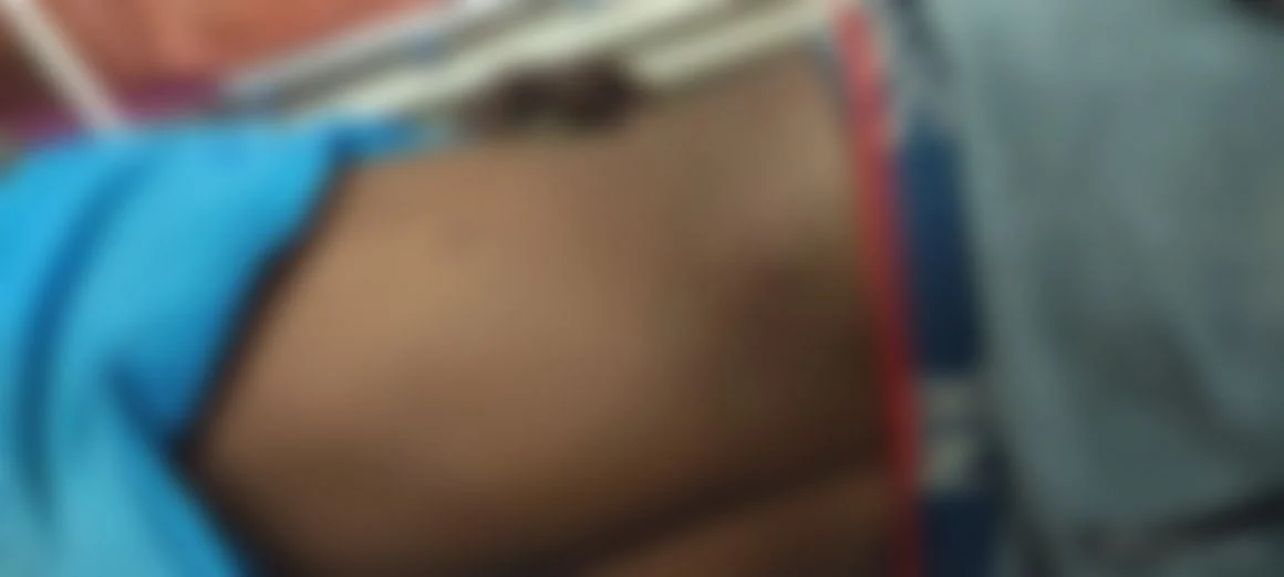 காயமடைந்த சங்கர்