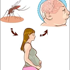 நோய் பாதிப்பு