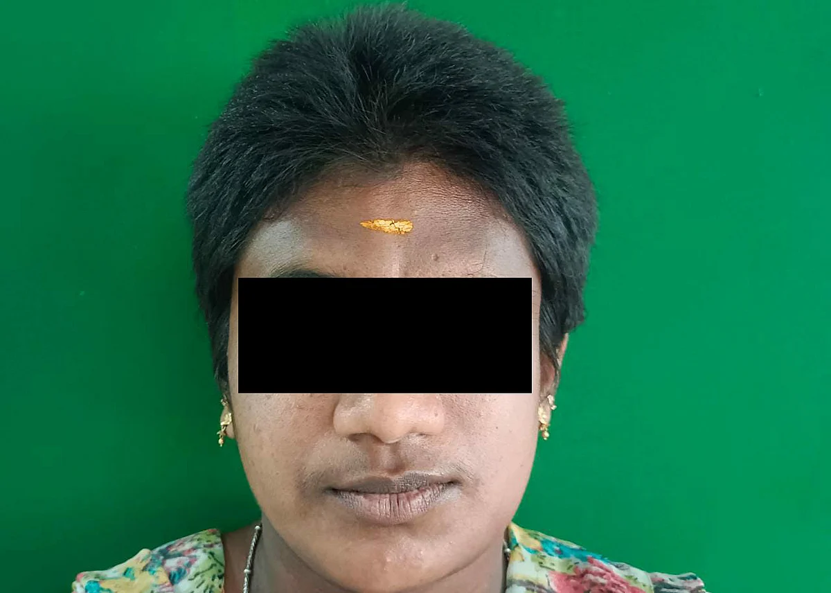 சிகிச்சைக்குப் பிறகு அந்தப் பெண்