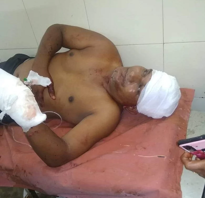 சிகிச்சையில் அக்பர் அலி