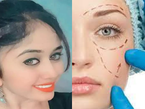 உயிரையே பறிக்குமா பிளாஸ்டிக் சர்ஜரி? நிபுணர் விளக்கம்!