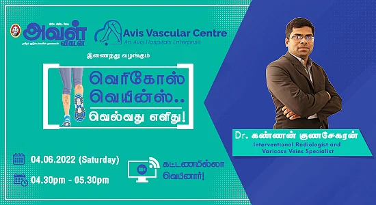 வெரிகோஸ் வெயின்ஸ் பிரச்னை...வெல்வது எளிது!