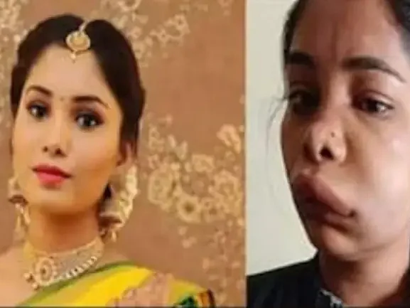 பல் சிகிச்சை செய்துகொண்ட கன்னட நடிகை; ஆளே அடையாளம் தெரியாமல் மாறிய சோகம்!