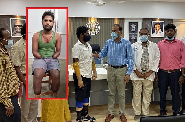 இதுவே முதன்முறை; அரசு காப்பீட்டுத் திட்டத்தின் கீழ் கோவை இளைஞருக்குச் செயற்கை கை, கால்கள் பொருத்தம்!