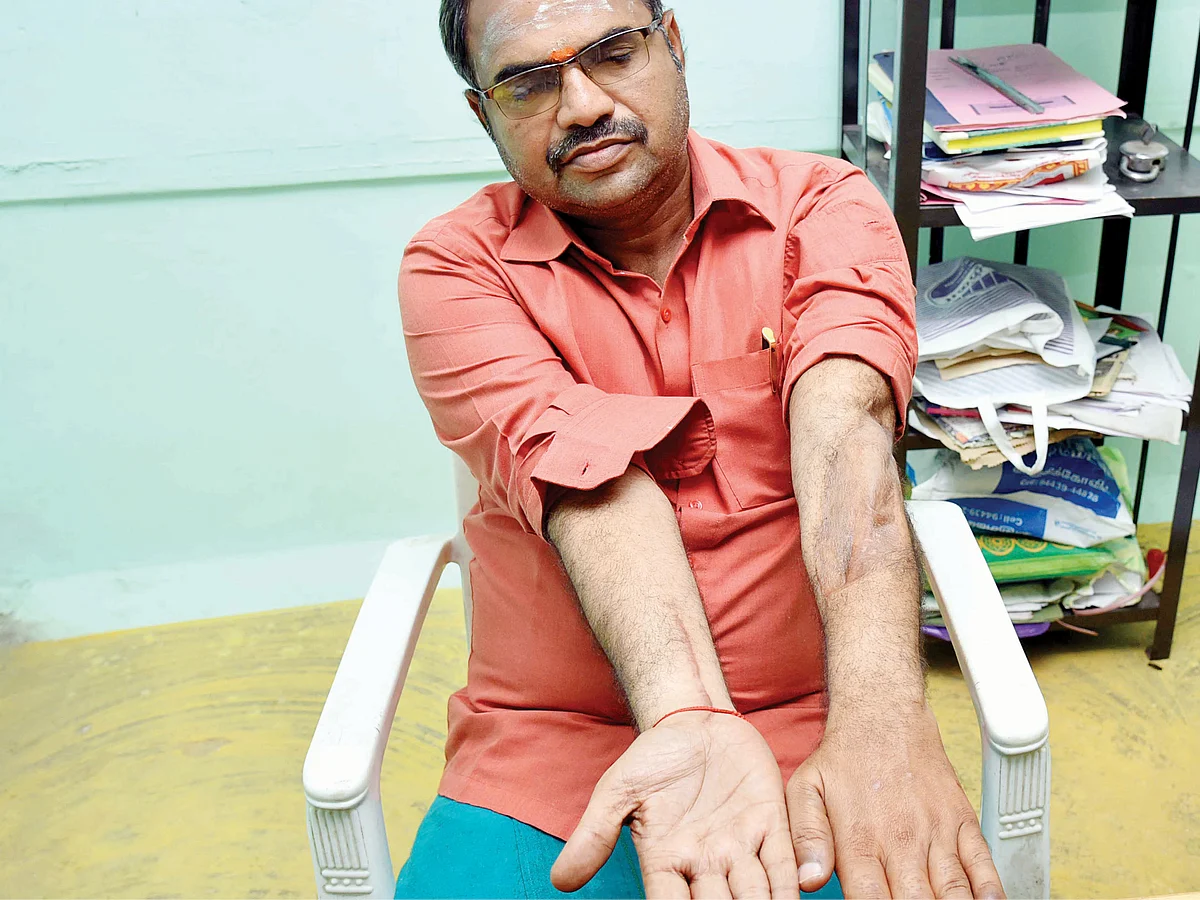 9 எலும்பு முறிவுகள்... 8 ஆண்டு போராட்டம்... போலீஸை ‘தண்டம்’ கட்டவைத்த சாமானியன்!