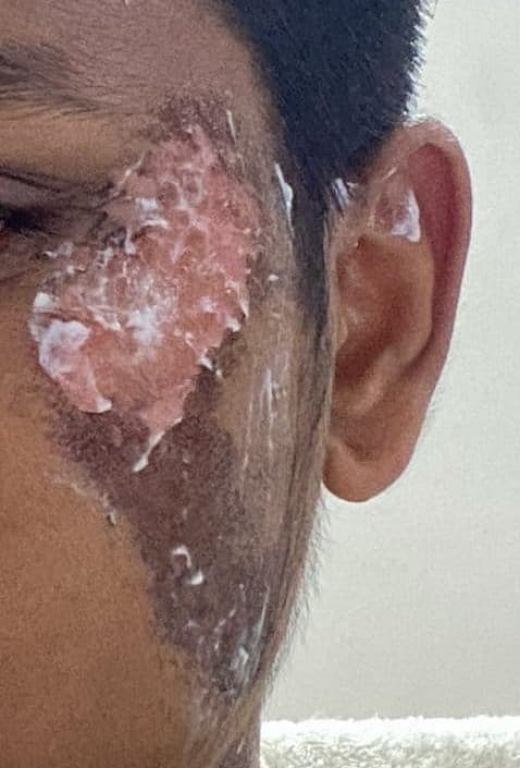 ஃபேஷியல் செய்யச் சென்ற சிறுவனுக்கு நடந்த துயரம், கோவை அழகு நிலைய உரிமையாளர் கைது: என்ன நடந்தது? 