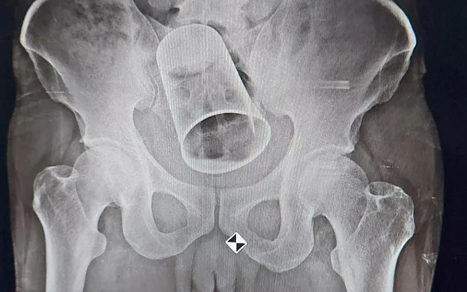x- ray