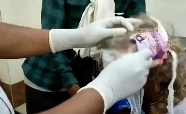 ஒரு பெண்ணுக்கு தலையில் காயம்