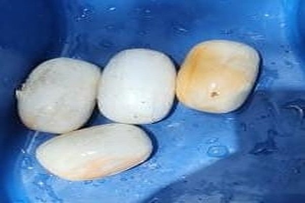 அயன் திரைப்பட பாணியில் ஒரு கிலோ தங்கம் கடத்தல்! - துபாயில் இருந்து வந்தவர் கைது