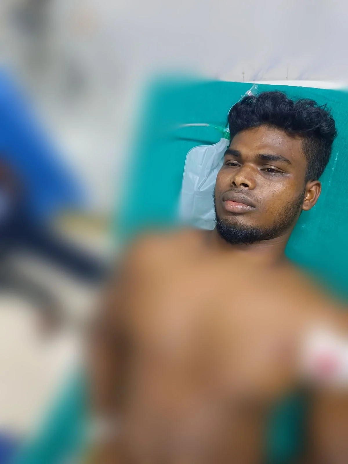 காயமடைந்த கார்த்தி