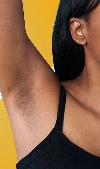 dark underarm removal