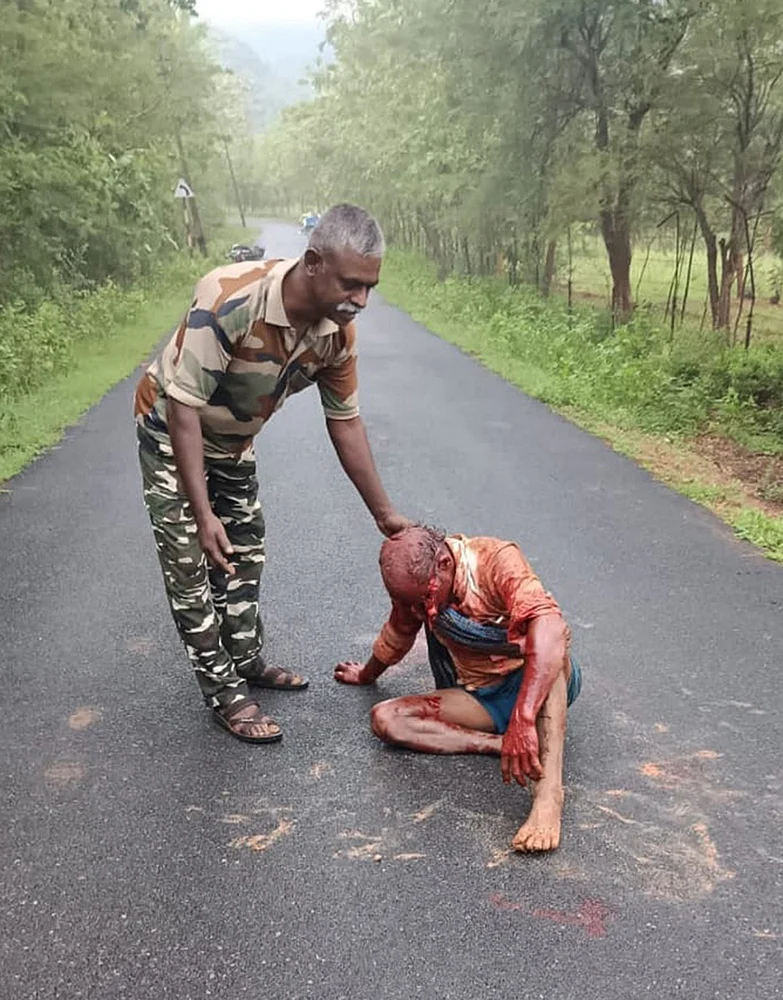 ஆக்ரோஷமான கரடி: மூன்று விவசாயிகளின் முகத்தை சிதைத்த கொடூரம்!