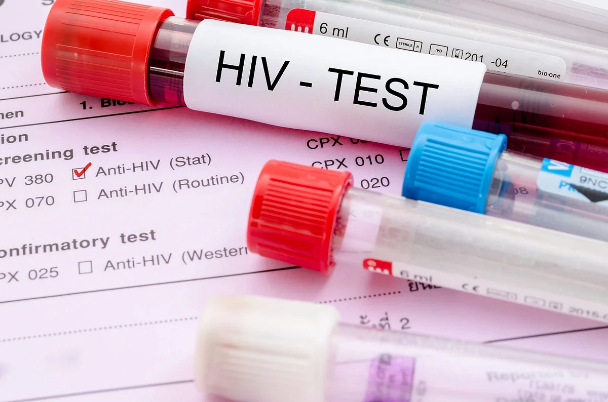 புதிய HIV வகை