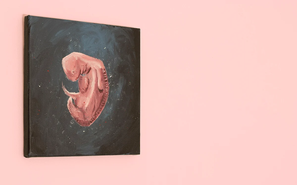 Abortion