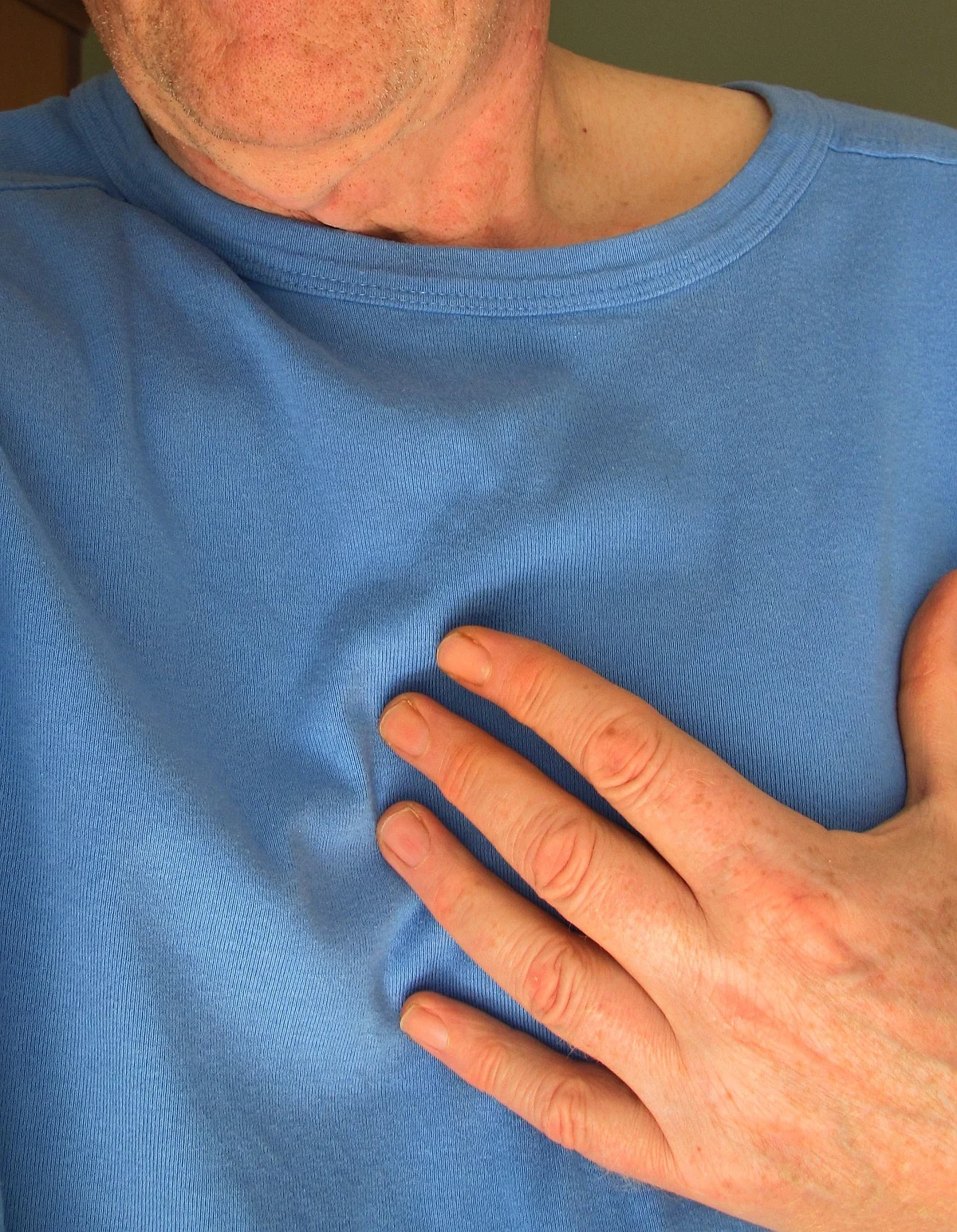 Heart attack