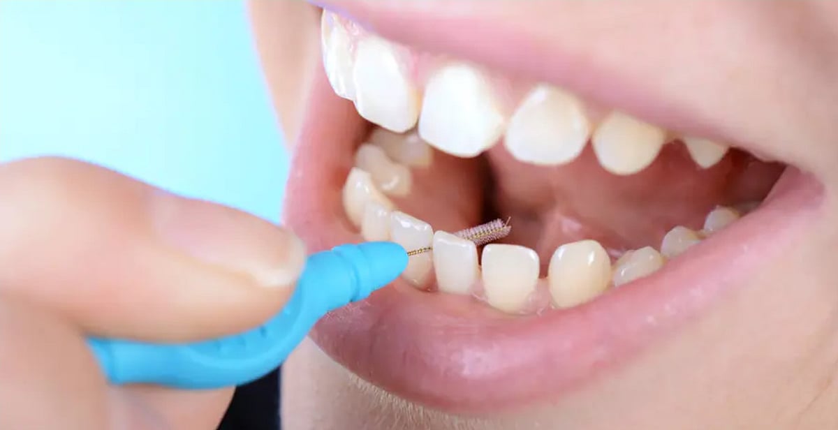 வாய் சுகாதாரம் | பற்கள் 