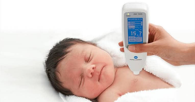 Transcutaneous Bilirubinometer (TcB)