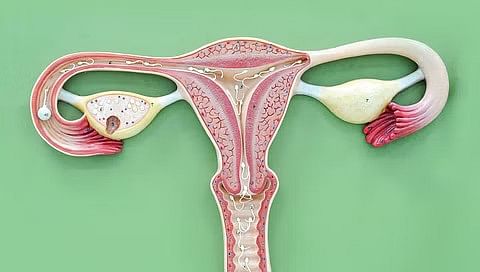 Cervical Cancer