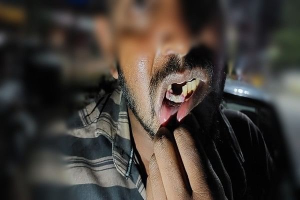 பல் பிடுங்கப்பட்டத்தைக் காட்டும் இளைஞர்