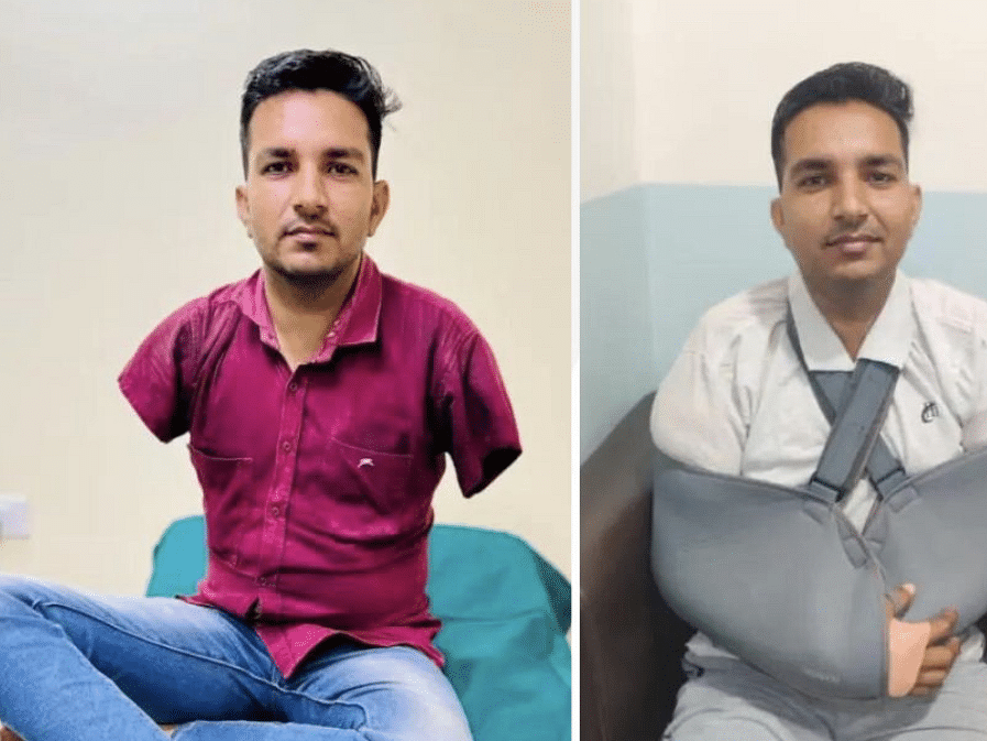 ஆசியாவின் முதல் முழுமையான கைகள் மாற்று அறுவை சிகிச்சை - சாதித்த மும்பை மருத்துவர்கள்!