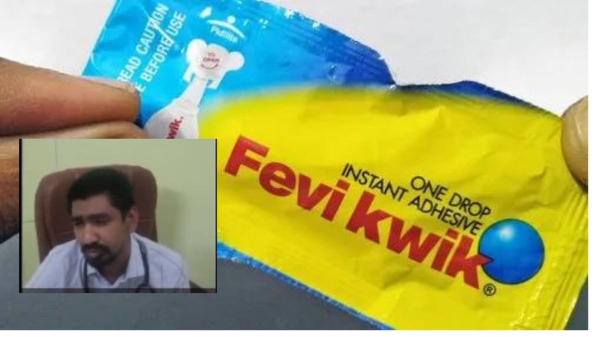 தையலுக்கு பதில் `Fevikwik' - தலையில் காயத்துடன் சென்ற சிறுவனுக்கு மருத்துவர் செய்த `பகீர்' காரியம்!
