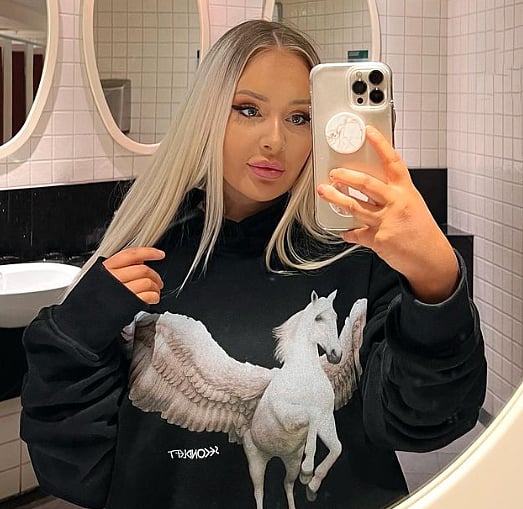 நிஜத்தில் பார்பி போல  இருக்க ஆசை; ரூ. 82 லட்சம் செலவிட்டு சிகிச்சை மேற்கொண்ட ஆஸ்திரேலிய பெண்!