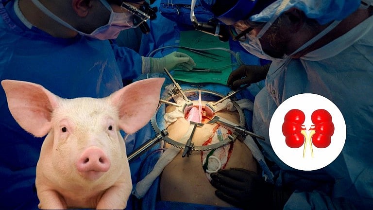 மனித உடலில் பன்றியின் சிறுநீரகம் - மகத்தான மருத்துவ சாதனை! எப்படிச் சாத்தியமானது?