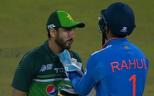 ஜடேஜா வீசிய பந்து; பாகிஸ்தான் வீரர் சல்மான் முகத்தில் ஏற்பட்ட காயம்! ஹெல்மெட் அணியாததுதான் காரணமா?