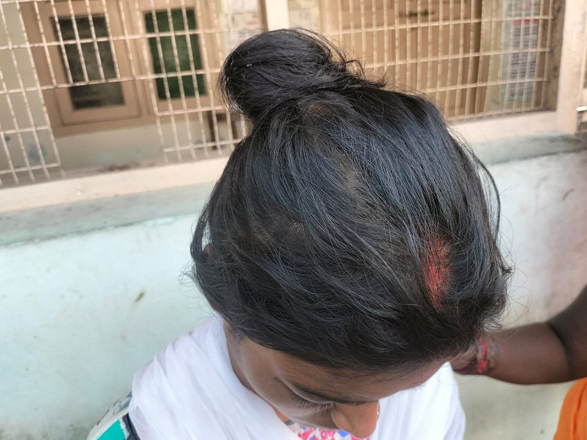 பாதிக்கப்பட்ட பட்டியலினப் பெண்