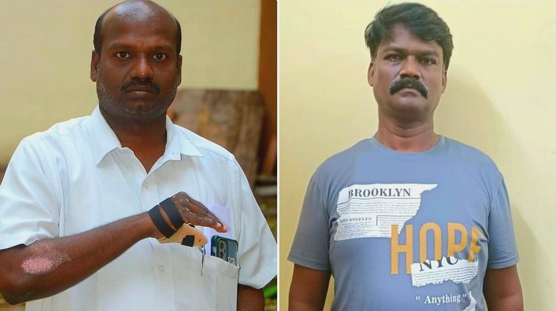 கார் ஏற்றி சமூக ஆர்வலரைக் கொல்ல முயற்சி... 25 நாள்களுக்குப் பிறகு வழக்கறிஞர் கைது - நடந்தது என்ன?!