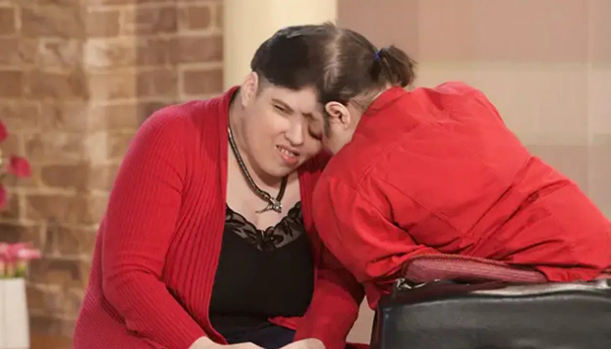 `உலகின் மிக வயதான ஒட்டி பிறந்த இரட்டை சகோதரிகள் மரணம்!'- இரங்கல் தெரிவித்த கின்னஸ் அமைப்பு