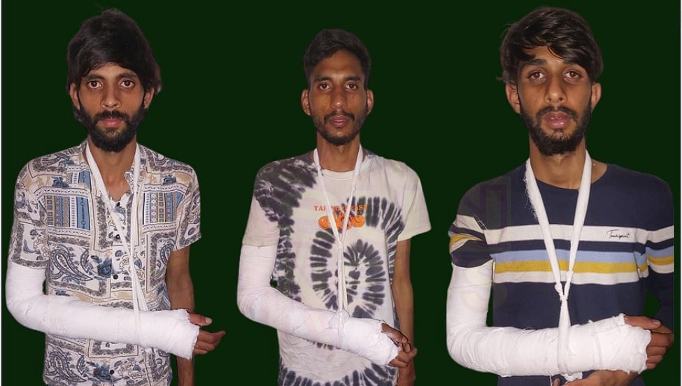 காவலர் மனைவியிடம் செயின் பறிப்பு; தப்பித்தபோது விழுந்து எலும்பு முறிவு; இளைஞர்களுக்கு மாவுக்கட்டு!