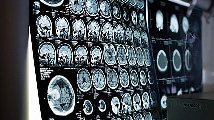 3 மடங்கு துல்லியம்... பிரான்ஸில் கண்டறியப்பட்டுள்ள `வேற மாதிரி' MRI scan கருவி!