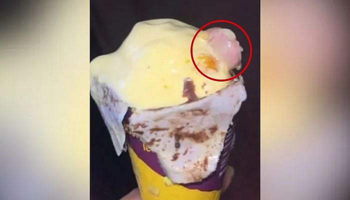 Ice Cream: `பருப்பு என நினைத்து விழுங்க நினைத்தேன்' -  ஐஸ்கிரீமில் மனித விரல்; அதிர்ந்துபோன டாக்டர்!