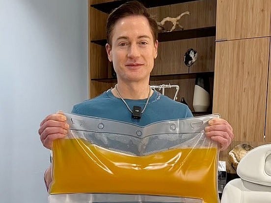 Bryan Johnson: `இளமை திரும்புதே...' வயதை ரிவர்ஸ் செய்ய முயற்சி; தொழிலதிபர் பகிர்ந்த வீடியோ