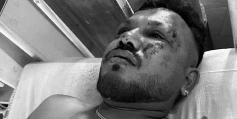 அகமதாபாத் விமான விபத்து: 